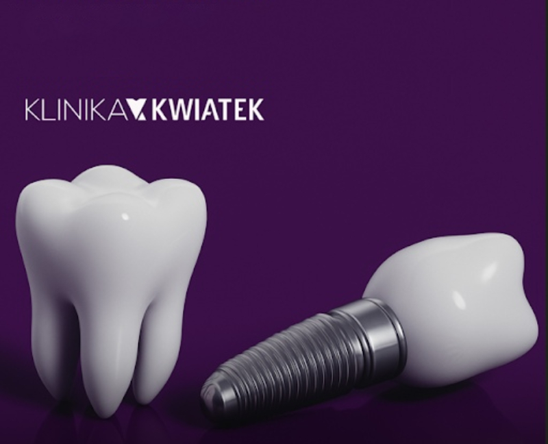 Metoda wszczepienia implantu, materiał implantu