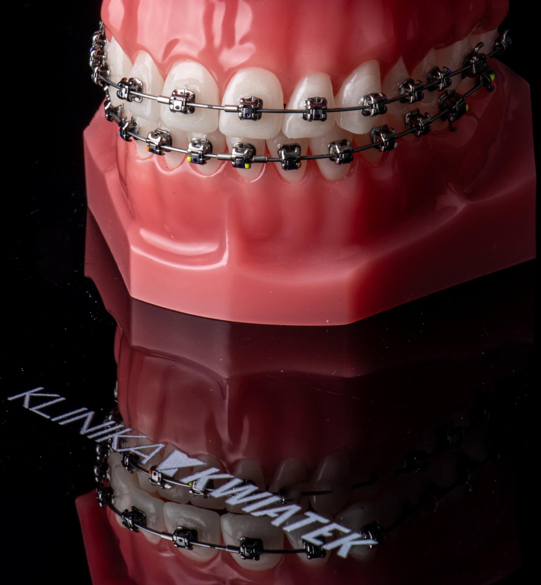 aparat ortodontyczny rodzaje - profesjonalne leczenie ortodontyczne 